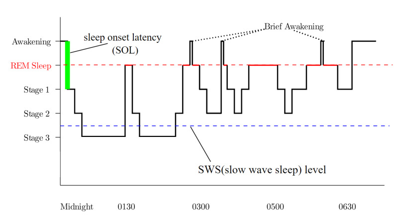 Sleep Stages 